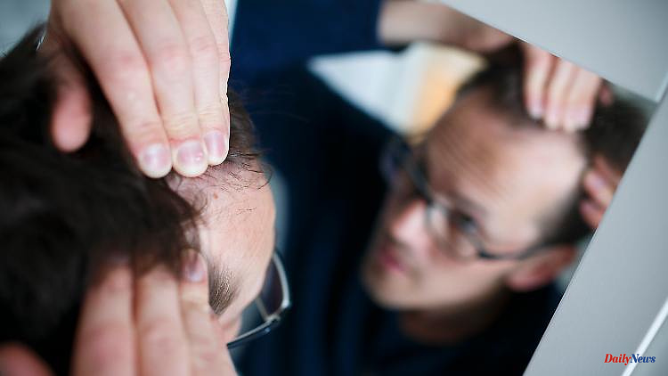 Corona drug against alopecia: USA approves tablets against hair loss