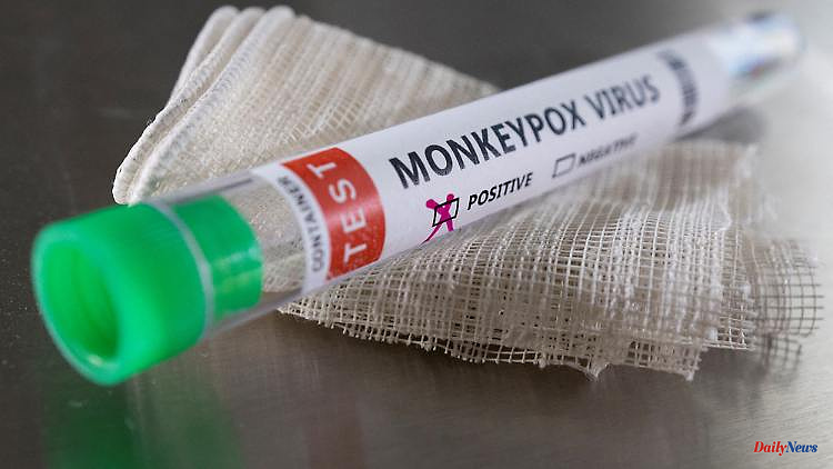 By more than a quarter: Massive increase in monkeypox cases in the UK