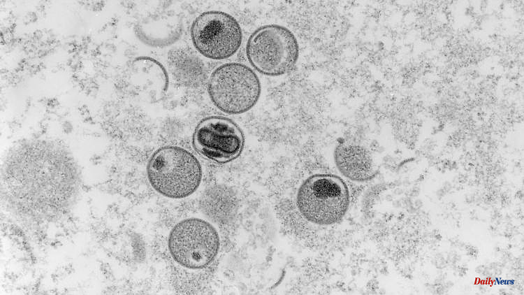 Virus behaves unusually: WHO examines health emergency due to monkeypox