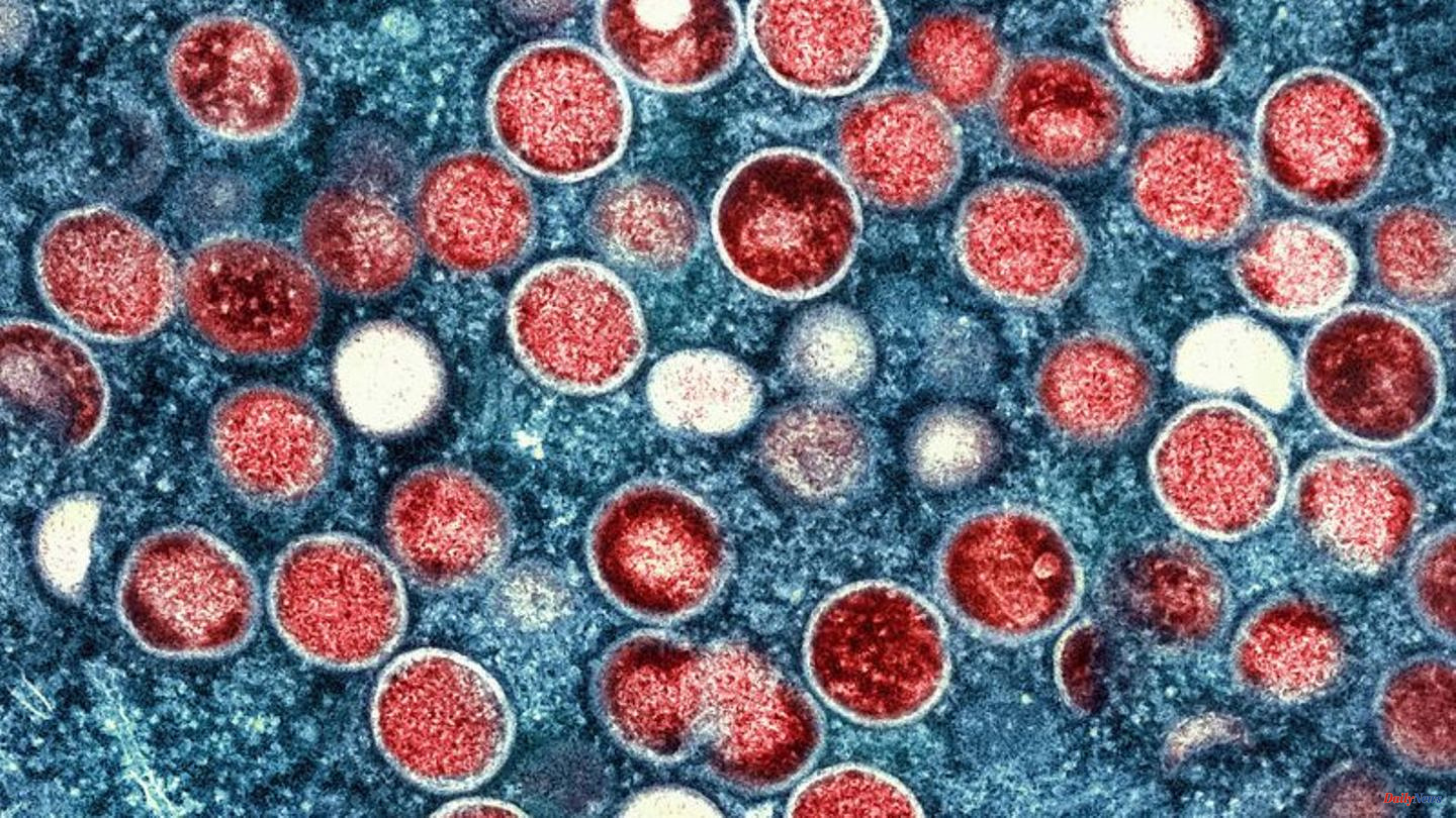 Diseases: Two young people in Germany infected with monkeypox