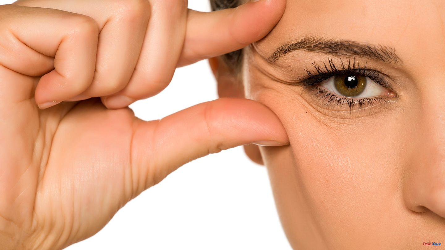 Expression lines: what helps against crow's feet? This is how you prevent small wrinkles around the eyes