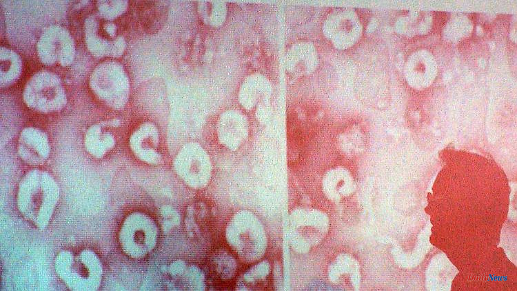 SARS outbreak 20 years ago: "The fourth phase of the epidemics"