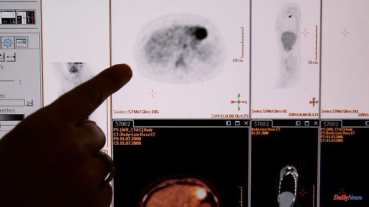 Forecast for 2023: Researchers expect 241,000 cancer deaths in Germany
