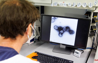 Four people in quarantine: monkeypox also detected in Cologne