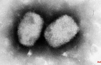 Doctors should be vigilant: RKI warns of monkeypox in Germany