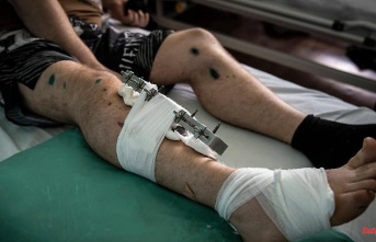 "One leg, that's nothing": Injured Azov fighter wants to go back to war