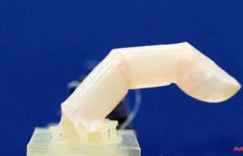 Self-healing ability: Robotic finger has artificial skin made from human cells