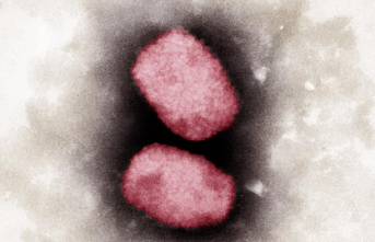 Monkeypox found in two children in the United States