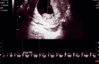 US abortion rules: Court passes controversial heartbeat law