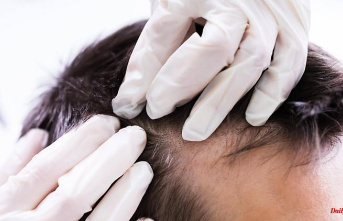 Researchers find cause: hair loss before healing? Study gives hope