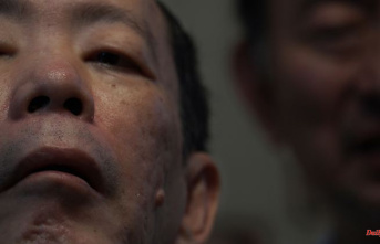 Japanese was never convicted: famous cannibal dies at 73