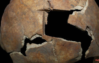 Similar method today: Researchers discover skull surgery 3,500 years ago