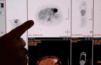 Forecast for 2023: Researchers expect 241,000 cancer deaths in Germany