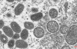 After confirmed case: Sweden declares monkeypox dangerous...