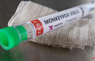 By more than a quarter: Massive increase in monkeypox...