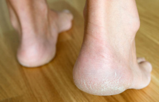 Beautiful feet: comparison of callus socks: This is...