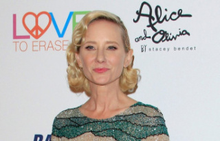 Anne Heche: She is in a coma after a fire accident