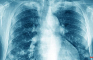 Use of fossil fuels: Possible cause of lung cancer...