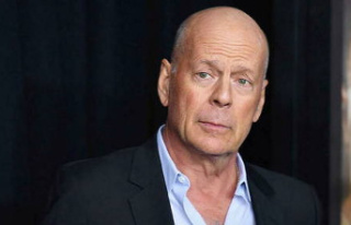 Bruce Willis: What is Frontotemporal Degeneration?
