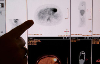Forecast for 2023: Researchers expect 241,000 cancer...