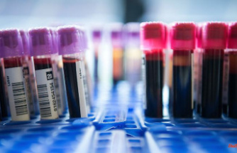 Should only cost around 50 dollars: New test detects 14 types of cancer at an early stage