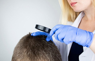 Combining Hair Transplant with Hair Care Regimens