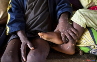 Pox epidemic in the DRC: 581 deaths since January and record number of cases over a year